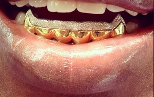Gold Teeth Caps Grillz mold kit 6 teeth Grills gold plated - white gold -10k - 14k /z12