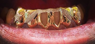 Gold Teeth Caps Grillz mold kit 6 teeth Grills gold plated - white gold -10k - 14k /z4