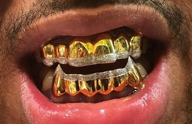 Gold Teeth Caps Grillz mold kit 6 teeth Grills gold plated - white gold -10k - 14k /z11