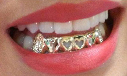 Gold Teeth Caps Grillz mold kit 6 teeth Grills gold plated - white gold -10k - 14k /z7