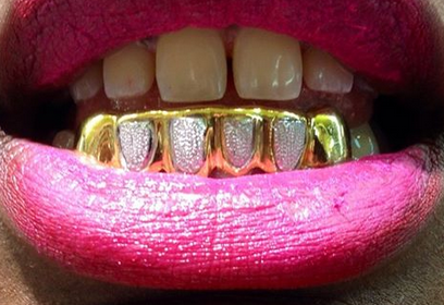 Gold Teeth Caps Grillz mold kit 6 teeth Grills gold plated - white gold -10k - 14k /z6