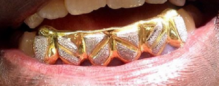 Gold Teeth Caps Grillz mold kit 6 teeth Grills /a 21